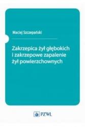 zakrzepica żył głębokich i zakrzepowe zapalenie żył po